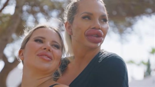 I've spent £37k on filler, my girlfriend's pregnant & trolls pray our baby dies