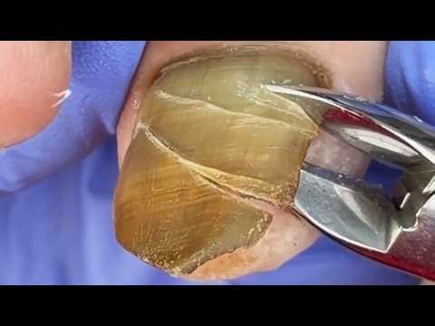 Black Nail Polish Almost Fell Off, Easy To Trim【Xue Yidao】