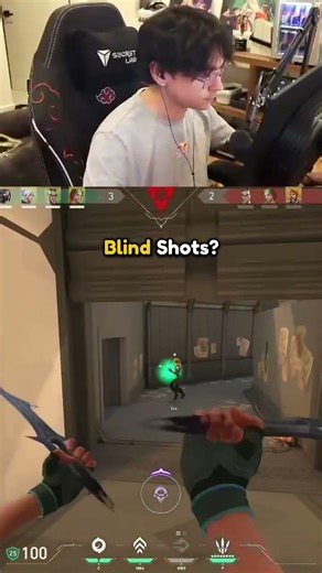 TenZ has rare gamer genes!💀#shorts