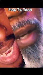 “Tupac & AKIL: Same Teeth, Same Energy? “Y’all ever noticed the teeth? 👀 What if Tupac didn’t really leave us… but lives on through AKIL the MC? 🔥 #TupacLives #AKILtheMC #MakaveliMystery #HipHopConspiracy” #TupacLives #Makaveli #AKILTheMC #HipHopMystery #PacVibes #RealHipHop #ConspiracyTheory #RapLegends #HipHopCulture | Legendary Baggs Media