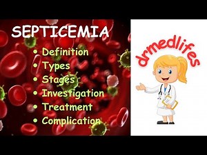 septicemia /sepsis types stages investigation treatment complications