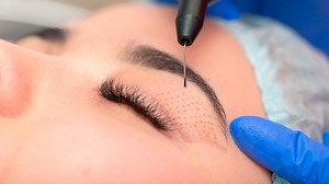 Plasma Pen en Costa Rica - Plaxpot en Costa Rica