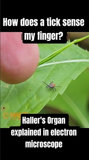 How does a tick feel my finger? Haller's Organ explained in electron microscope.