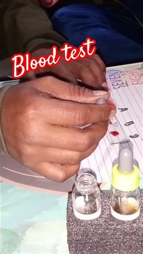 #science project #blood test #your blood group comments