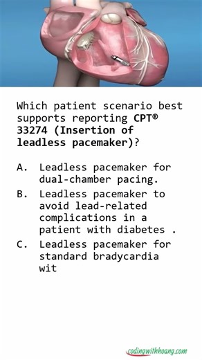 Leadless Pacemaker Coding