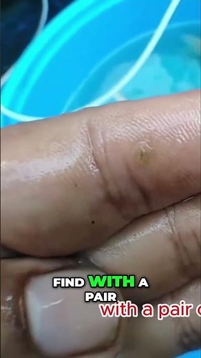 Koi Lice SOS! Quick Fix to Save Your Fish (Sterilize & Remove)