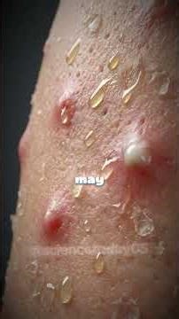 What happens if you inject testosterone? #science #facts