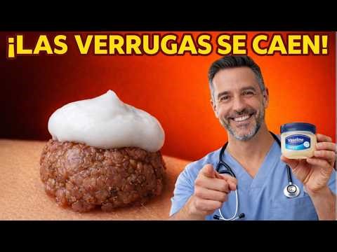 Doctor Revela: Verrugas y Papilomas DESAPARECEN cuando haces ESTO (pero casi NADIE lo hace bien)