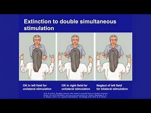 Lec 8 | MIT 9.00SC Introduction to Psychology, Spring 2011