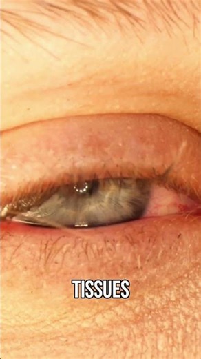 Swollen Feet | You May Have Lost 60% Kidney Function!