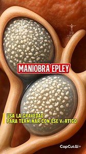 🌀👂✨ La maniobra de Epley es una técnica utilizada en medicina para tratar el vértigo posicional. Ayuda a recolocar los otolitos dentro del oído interno, reduciendo los mareos y la sensación de giro al mover la cabeza. Cuando se realiza correctamente, puede aliviar los síntomas en pocos minutos. #CuerpoHumano #OídoInterno #Vértigo #Medicina #Salud Educar es salvar vidas. Comparte este mensaje. | 𝐴𝑝𝑟𝑒𝑛𝑑𝑒 𝑑𝑒 𝑠𝑎𝑙𝑢𝑑 , 𝑙𝑒𝑎𝑟𝑛 𝑎𝑏𝑜𝑢𝑡 ℎ𝑒𝑎𝑙𝑡ℎ