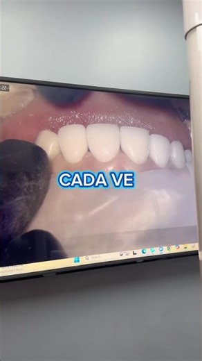 ✨Precisión que se nota en cada sonrisa ✨