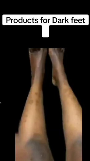 Effective Solutions for Dark Feet | Tips & Products