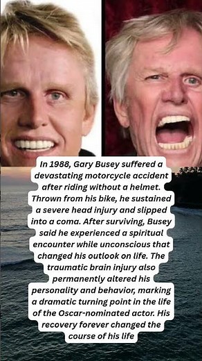 Gary Busey The Crash That Changed Everything #foryou #youtubeshorts #viral #1millionviews #bollywood