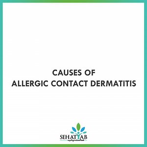 5.4K views · 47 reactions | Allergic contact dermatitis is a form of dermatitis/eczema that is caused by an allergic reaction to a material when it comes in contact with the skin. Learn what some of its causes are so you can take protective measures against it! | SehatYab | Facebook