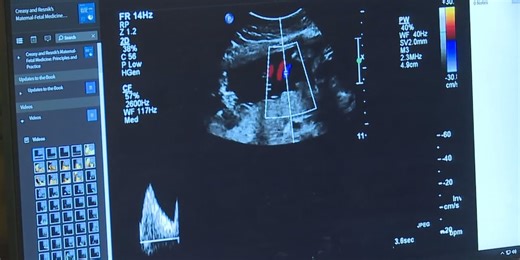 Pro-choice OBGYN, attorney: New state video creates confusion