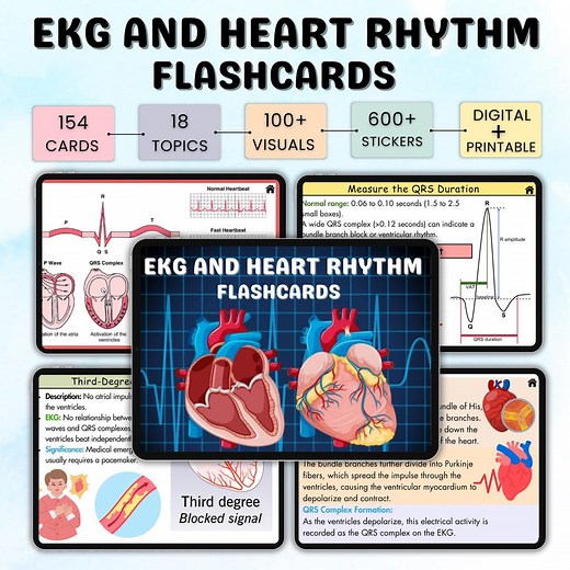 150+ EKG and Heart Rhythm Flashcards | EKG Study Guide | ECG or Ekg Interpretation | Cardiac Study Guide | Ekg Rhythms | Nursing Notes - Etsy