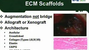 Orthobiologics in Rotator Cuff Repair - What you Need to Know