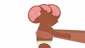 Take 5 and Prevent Shaken Baby Syndrome Shaken Baby Syndrome occurs when a frustrated caregiver shakes an infant, causing severe brain and spinal injuries. It is natural to find taking care of a baby challenging, but caregivers should follow the Take 5 plan to give themselves a break, walk away and return to the baby calmly. By taking the time to reduce the frustration associated with a baby’s crying, the child’s wellbeing is protected. Watch the animation to find out more: https://youtu.be/40Ez