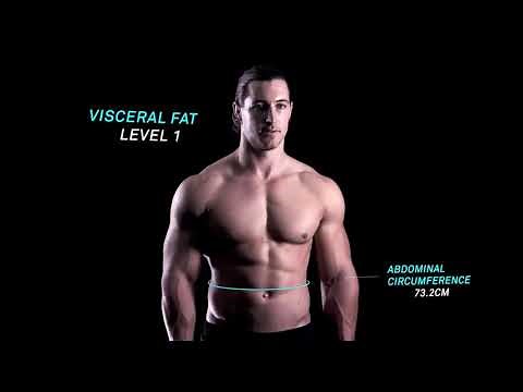 Evolt 360 Body Scanner