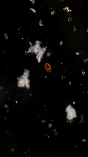 How Dark-Field Microscopy Works | Rasool Jafari posted on the topic | LinkedIn