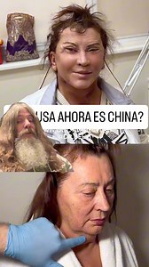 "When Plastic Surgery Turns You Into a Nightmare" Plastic surgery disasters can leave people looking unrecognizable, with features so altered they resemble creatures from another world. From overdone fillers to botched procedures, the quest for beauty can sometimes lead to unexpected and shocking outcomes. Learn the risks of going too far in the name of perfection #PlasticSurgeryFails #Botched #CosmeticSurgeryGoneWrong #BeautyDisaster #UnnaturalTransformation #BeCareful #LessonsInVanity #Surgery