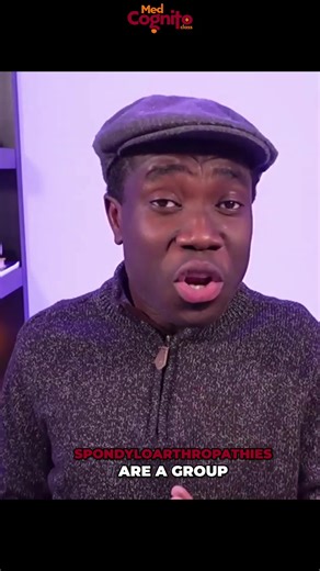 Spondyloarthropathies: Not one disease, but a spectrum. Spotting the patterns is key. Don't miss this on your board exam! #Spondyloarthropathy #AnkylosingSpondylitis #PsoriaticArthritis #ReactiveArthritis #Arthritis