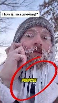 Top 5 Bizzare Human World Records Should NOT Exist 😨🏆