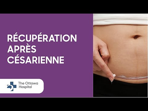 Comment se rétablir d'un accouchement par césarienne