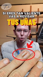 1.2M views · 31K reactions | Si te crees tan valiente vas a revisar que esa uña esté bien , es algo completamente curable, pero primero se debe detectar ✌ más en YT #Medicina #SabiasQue #curiosidades | Dr Polo Guerrero | Facebook