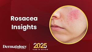 Dermatology Times 2025 Year in Review: Rosacea | Dermatology Times