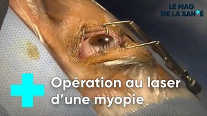 Maximize Your Savings: Get the Best Laser Eye Surgery Reimbursement through Your Optical Insurance - Générale Optique