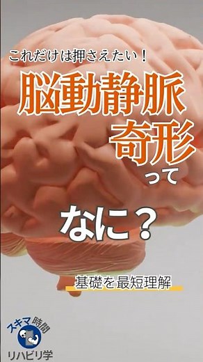 【基礎】脳動静脈奇形ってなに？PTなら知っておきたい基礎 #理学療法士国家試験 #理学療法士 #作業療法士国家試験 #作業療法士 #基礎 #脳 #脳出血 #脳卒中 #脳動脈瘤 #脳動静脈奇形