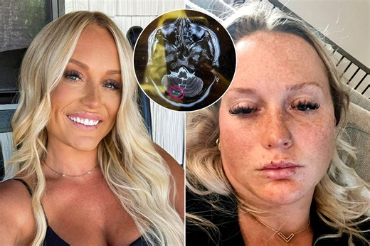 Mum unable to speak & paralysed by 'Botox-like jabs' that triggered mini strokes