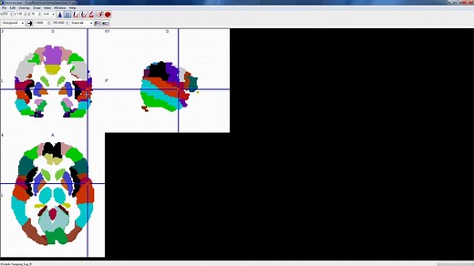 温老师谈心-神经影像可视化软件Mricron教程-快速入门