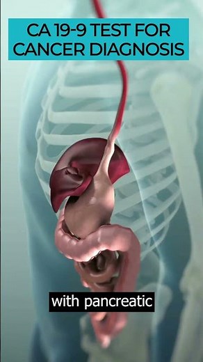 Delve into the CA19-9 test & its role in diagnosing & monitoring certain types of cancer. #CA199Test