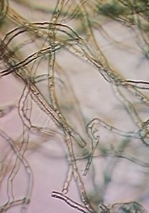 Fungus streaming: where to watch movie online?