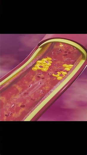 Cholesterol Explained in 3D | Medical Animation #3dcompositing #3danimation #automobile #spiderman