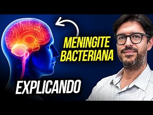 Meningite Bacteriana - O Que é Meningite Bacteriana