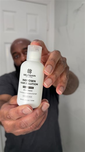 The cleanest shaves bump up the worst. Most bald men think closer is better. It’s not. Too many passes. Hot shower right after. No recovery. Perfect today. Inflamed tomorrow. Day-2 exposes the routine. #smoothcrownformula #RazorBumps #houstonbarber