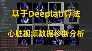 附源码 数据集】手把手教你基于Deeplab算法实现心脏图像分割实战，看完就能跑通！毕设/课设/深度学习/神经网络 /Deeplab/pytorch/研究生