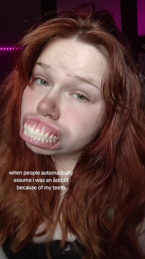 Confident Smiles: Life with Dentures at a Young Age