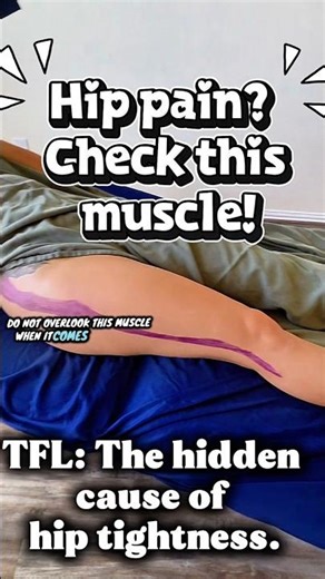 Hip Pain Explained: The TFL & IT Band Connection | Lower Cross Syndrome Breakdown