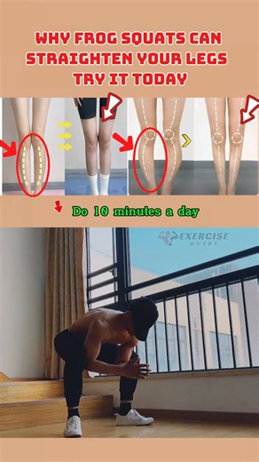 Why Frog Squats Can Straighten Your Legs — Try It Today #fblifestyle | Exercise Guide