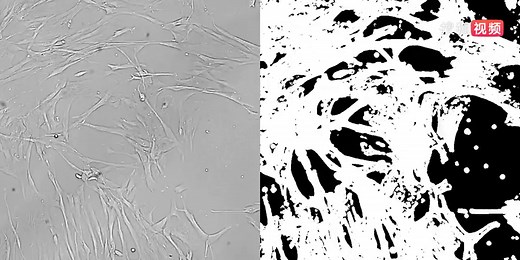 Fibroblast Cells Migration as Part of a Wound Heal