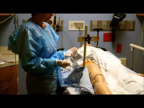 Arterial Line Pull Using a C Clamp