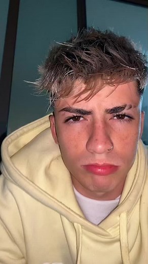 ¿Por qué tengo los cachetes rojos?