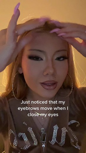 My body is weird 🥲😭 #bpes #bpesawareness