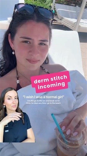 Dr. Aleksandra Brown on Instagram: "Yes, you can be allergic to the sun — and it’s more common than you might think. Imagine stepping outside to enjoy the warm weather, only to develop an itchy rash, hives, or bumps hours later. For some people, this isn’t just sensitive skin — it’s a real condition. It’s called Polymorphous Light Eruption (PMLE) — an immune system reaction to UV light. 🔹 A few hours or days after sun exposure, your immune system goes into overdrive, causing an itchy rash, hive