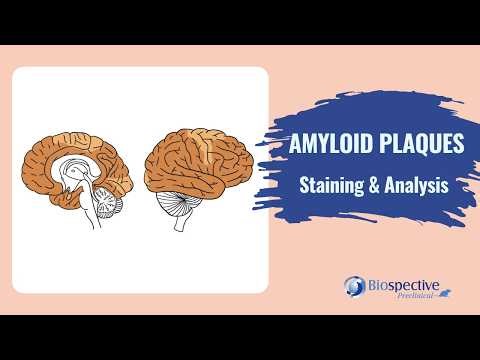 Amyloid Plaques Staining & Analysis - Video Overview